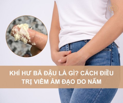 Hình ảnh khí hư bã đậu là bị làm sao? Cách chữa hiệu quả