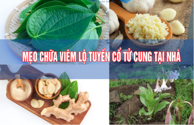 Viêm lộ tuyến cổ tử cung: Nguyên nhân, dấu hiệu và cách chữa
