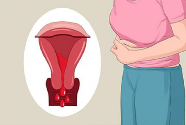 11 cách chữa rong kinh nhanh nhất tại nhà đơn giản