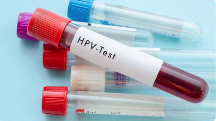 11 địa chỉ xét nghiệm HPV ở đâu tốt nhất tại Hà Nội