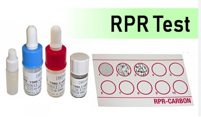 Xét nghiệm RPR là gì? Tại sao cần làm xét nghiệm RPR