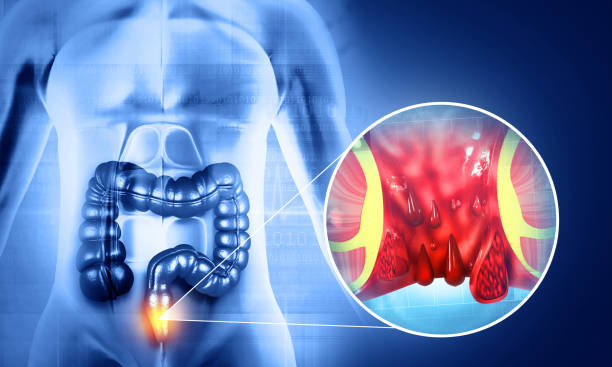 Đại tiện ra máu khám ở đâu? 6 Địa chỉ chữa đi cầu ra máu