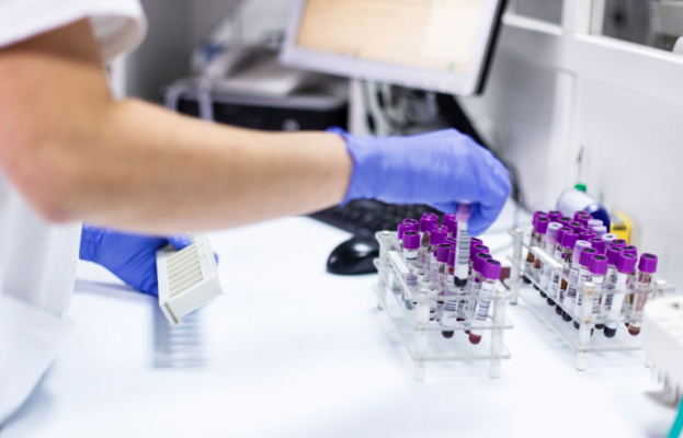 xet-nghiem-pcr